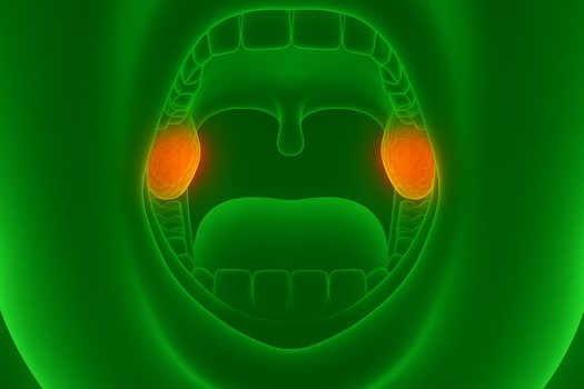 tumori_maligni_del_cavo_orale_green_r